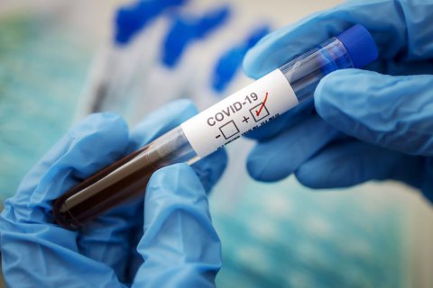 За минулий тиждень у Києві виявили більше ста нових випадків захворювання на коронавірусну інфекцію